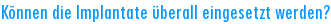 K�nnen die Implantate �berall eingesetzt werden?